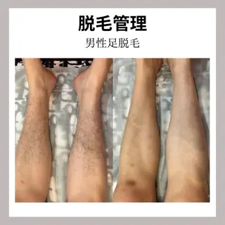 WAX・肌質改善・毛 穴洗浄/林愛真のエステ・リラクイメージ