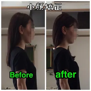 トレイン 鍼灸マッサージ治療院のエステ・リラクイメージ