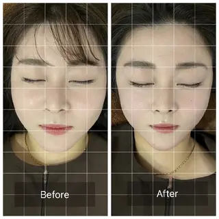 Spring鍼灸院 ✨首肩こり、腰痛に！のその他イメージ