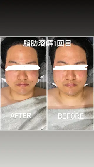 アルカンジュ~archange~所属・痩身/毛穴洗浄/脱毛 アルカンジュのエステ・リラクイメージ