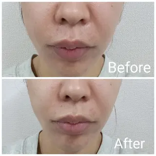 肌質改善Beauty salon Renのエステ・リラクイメージ