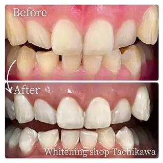 セルフ　ホワイト ニングショップ立川のその他イメージ