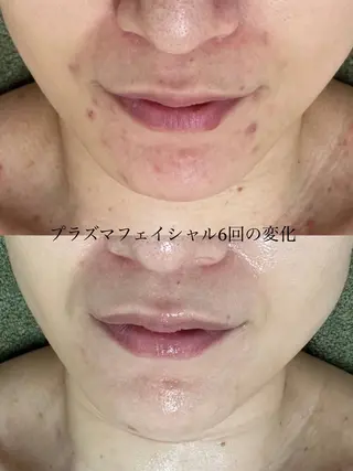 韓国美肌/肌質改善 【天神】のエステ・リラクイメージ