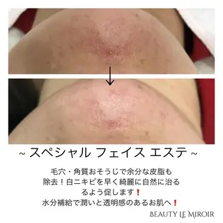 ビューティー ミロワールのエステ・リラクイメージ