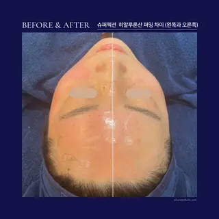 Monreve所属・美人スイッチdiet スーパージェクションのその他イメージ