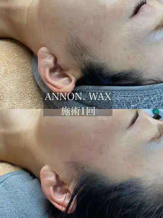 肌質改善ワックス専門 yukiのエステ・リラクイメージ