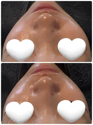 Lulu estheticsalon所属・田村 梨乃のエステ・リラクイメージ