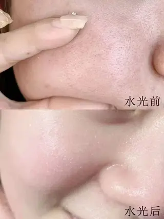 ショート aliaハイフ&水光ジェットサロン所属・aliaハーブ水光店 エステティシャン募集のエステ・リラクイメージ