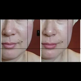 Nako  ﾅｺのエステ・リラクイメージ