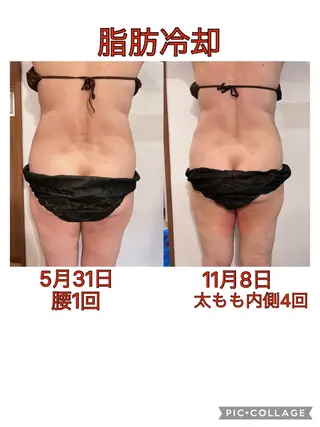 Corazon コラゾンのマツエク・マツパデザイン