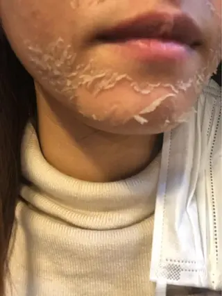 Momo Eggsのエステ・リラクイメージ