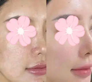 マツエク・マツパ 愛維美水光美肌専門店 メンズレディースokのエステ・リラクイメージ