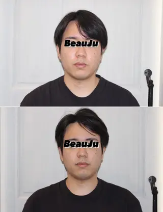 小顔矯/美容鍼/鍼灸 BeauJuのその他イメージ
