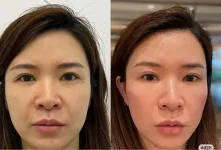 ネイル aliaハーブ水光店 エステティシャン募集のエステ・リラクイメージ