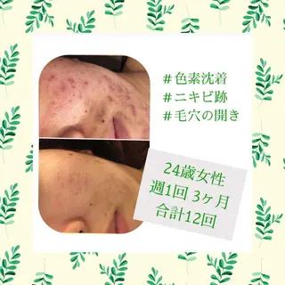 ミディアム カラー パーマ ヘアアレンジ メンズ キッズ ネイル マツエク・マツパ ニキビ・肌質改善専門 ♡人生が変わるサロンのエステ・リラクイメージ