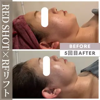小顔矯正専門店 【RED】池田のエステ・リラクイメージ