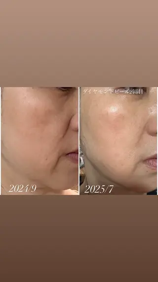 ヘッドスパ専門/豊中 apricotのエステ・リラクイメージ