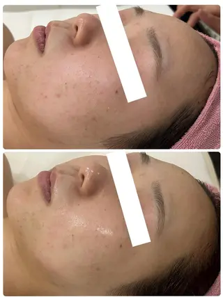 ♡RAYVIS♡ 名古屋店　神田のエステ・リラクイメージ