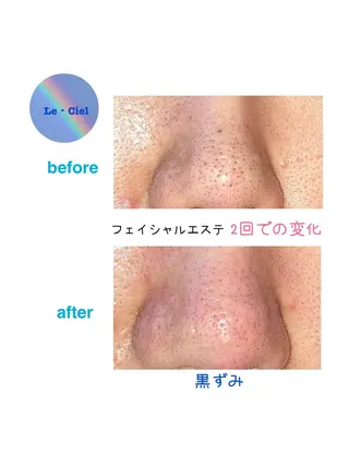 フェイシャルエステLe・Ciel所属・Le・Ciel フェイシャル&ボディのエステ・リラクイメージ
