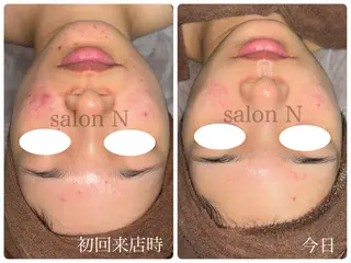 24時間営業 ハーブ/毛穴洗浄のエステ・リラクイメージ