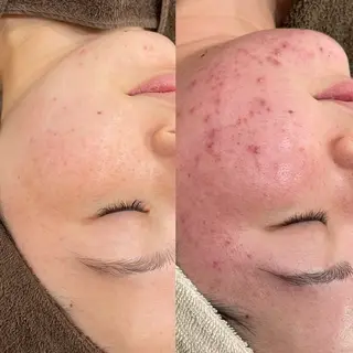 Tug 高知駅前店/ NANAMI🌐のエステ・リラクイメージ