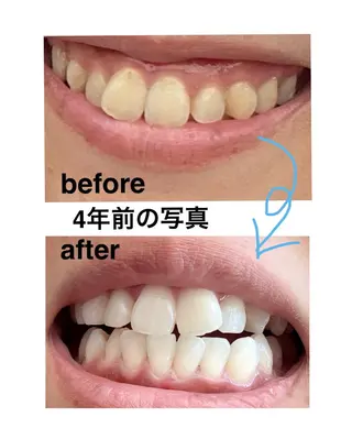 ホワイトニングショップ津店所属・ホワイトニング ショップ津店のその他イメージ