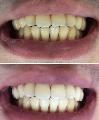 Venus Beauty銀座のマツエク・マツパデザイン