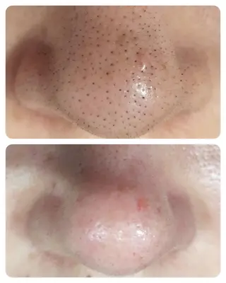 エステサロン LYSHのその他イメージ