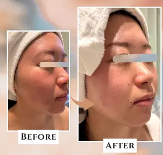 POLA  Feliz    守山店所属・✨肌質改善✨毛穴ケア POLA稲越美鈴のエステ・リラクイメージ