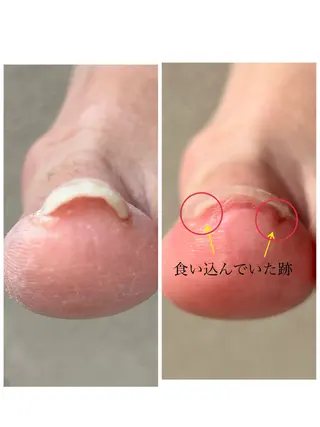 メンズ ネイル Chérinail 爪のお手入れのネイルデザイン