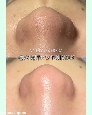 Diailes 💎ななのエステ・リラクイメージ