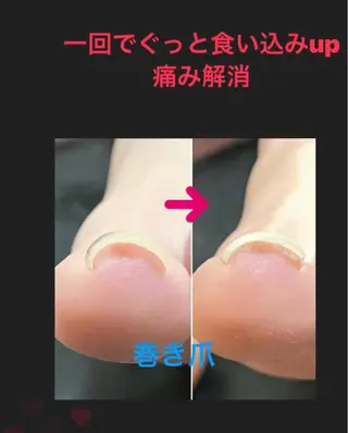ネイル ネイルスペースR 小林のネイルデザイン