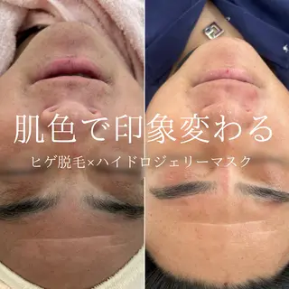 etre - 韓国肌管理 -のエステ・リラクイメージ