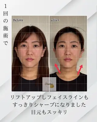 Riradieux ﾘﾗﾃﾞｭ所属・Riradieux 美骨小顔矯正のその他イメージ