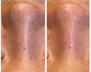 メンズ 美 Faceのエステ・リラクイメージ