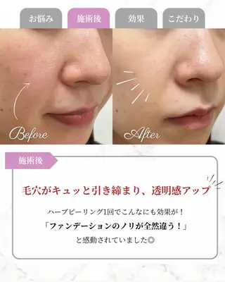 Astorie 相模大野エステのその他イメージ