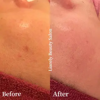 リアレリー 🪞🌹Ryokoのエステ・リラクイメージ