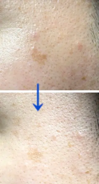 朝重い人専用 肩甲骨調整のエステ・リラクイメージ