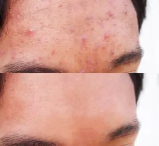 肌質改善サロン renew/ｳｴｷのエステ・リラクイメージ