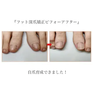 ネイル ネイルサロン アリュームのネイルデザイン