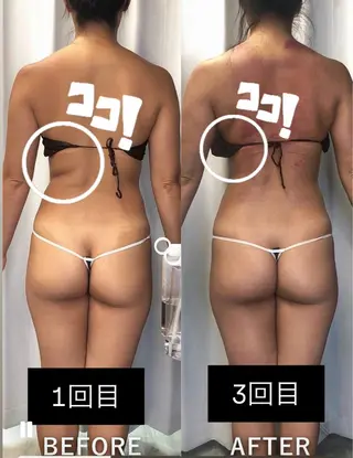 痩身・脱毛・肌管理 Rechica心斎橋のエステ・リラクイメージ