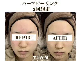 美肌サロンTIAM by tetoteのエステ・リラクイメージ