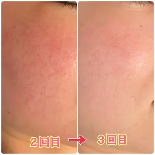 稲角 芹香のエステ・リラクイメージ