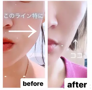 🅖🅤🅩🅔🅛 salonのエステ・リラクイメージ