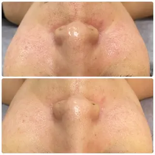 ResetLab 佐藤 風香のエステ・リラクイメージ