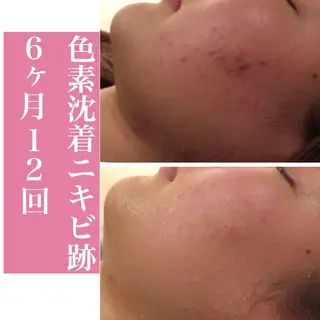 ニキビ・肌質改善専門 ♡人生が変わるサロンのエステ・リラクイメージ