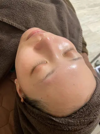 肌質改善・小顔サロン 20代店長RINNAのエステ・リラクイメージ