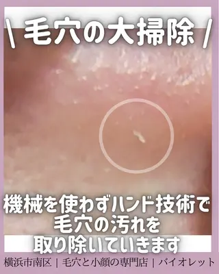 毛穴と耳つぼ専門店 バイオレット　りののその他イメージ