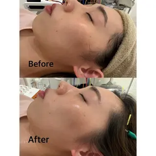 鍼灸サロン mahorobaトモのエステ・リラクイメージ