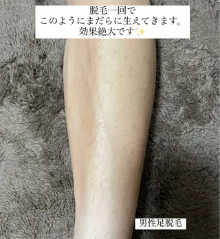 メンズ Anela .のマツエク・マツパデザイン